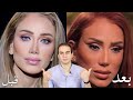 دكتور تجميل يوضح حقيقة ما حدث لوجه ريهام سعيد 
