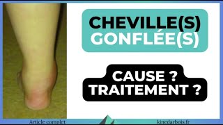 Cheville gonflee avec ou sans douleur : cause, remède - YouTube
