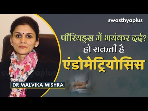 एंडोमेट्रियोसिस, जानिए इलाज और बचाव के तरीक़े। Dr Malvika Mishra on Endometriosis in Hindi