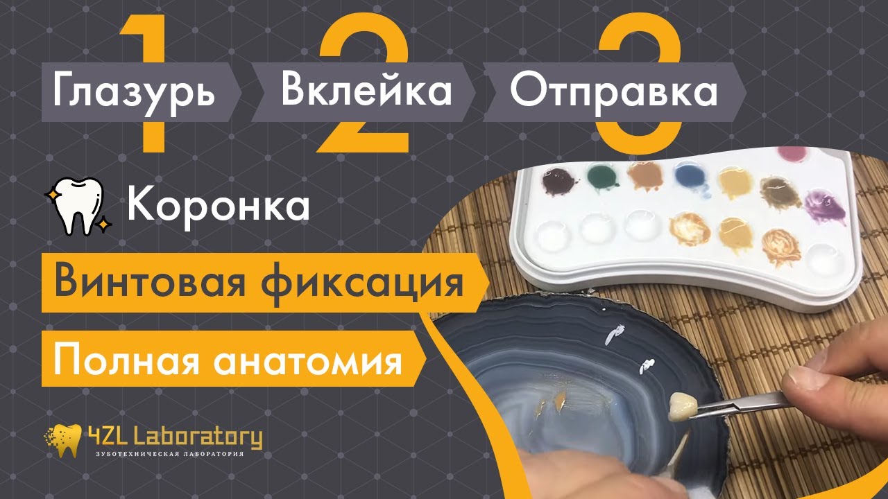 Глазурь, вклейка, отправка Zr. Винтовая фиксация, полная анатомия