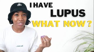 MY LUPUS STORY | LIVING WITH LUPUS | 2 Weeks Since Diagnosis *FIRST YOUTUBE VIDEO