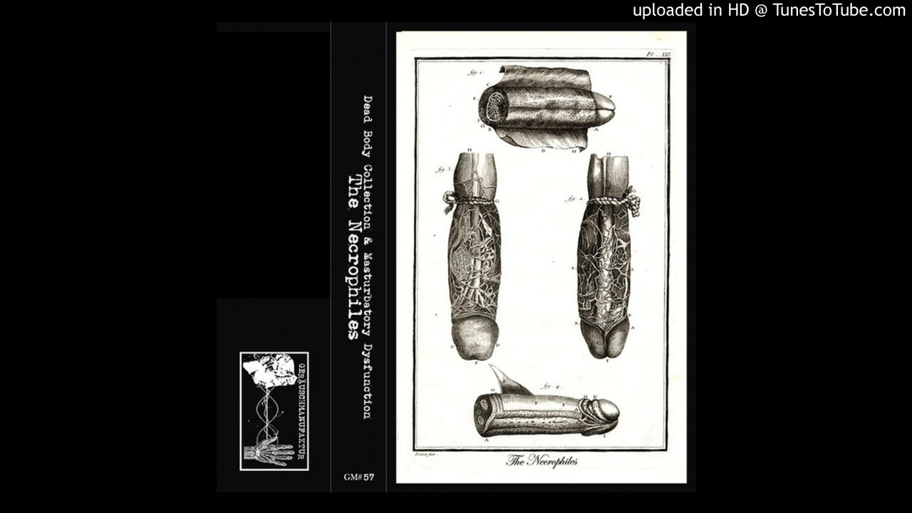 Dead Body Collection/Mastrubatory Disfunction - Death During Sexual Self- Stimulation