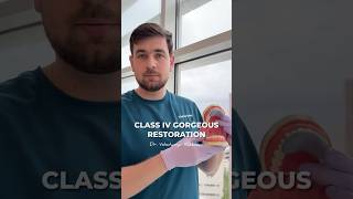 Class IV: A Simple Guide to Flawless Restoration