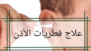 علاج فطريات الأذن د محمد القرشلي.. شاهدوا الفيديو للآخر