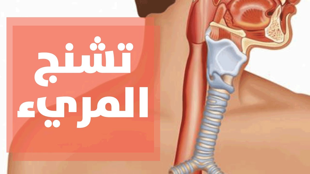 تعرفوا على أسباب تشنج المريء