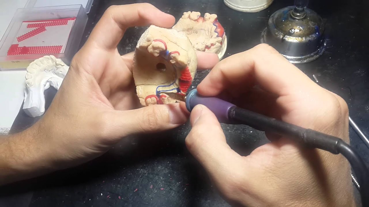 Escultura de PPR completo