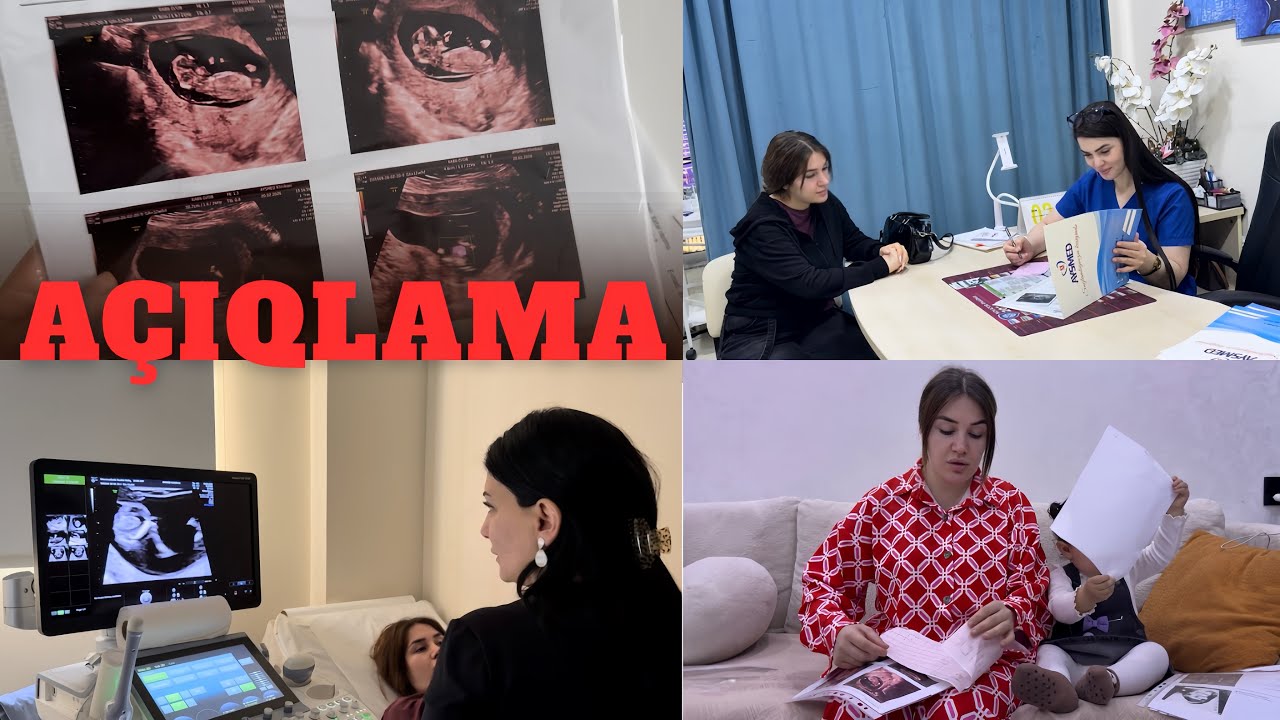 ‼️20 GÜNDÜ NİYƏ YOX İDİM? GÖZLƏDİYİNİZ AÇIQLAMA VİDEOSU GƏLDİ ‼️