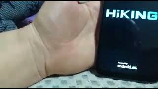 HİKİNG A41  ANDROİD TELEFON İNCELEME KUTU ACİLİMİ