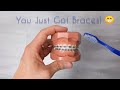 How to care for your new braces and your teeth!