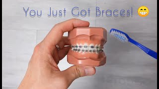 How to care for your new braces and your teeth! screenshot 4