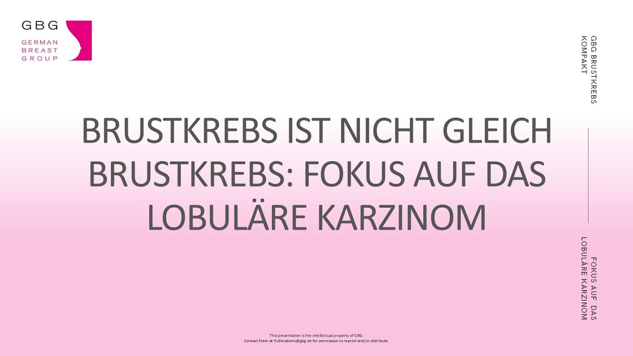 Brustkrebs kompakt erklärt: Brustkrebs ist nicht gleich Brustkrebs: Fokus auf das lobuläre Karzinom