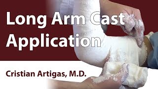 Long Arm Cast Application