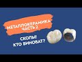 Металлокерамика (ч.2). Сколы. Кто виноват?