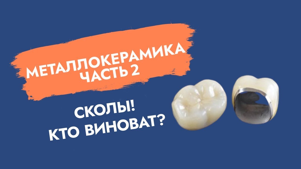 Металлокерамика для двигателя