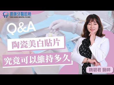【陶瓷貼片白度可維持多久】快來聽聽魏碧君醫師怎麼說～＃台中南屯牙醫 #美白貼片 #陶瓷貼片