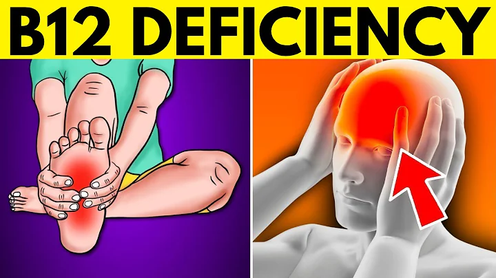 10 Symptoms of Vitamin B12 Deficiency You Should Never Ignore