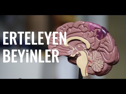 Erteleyen ve harekete geçen beyin farkı