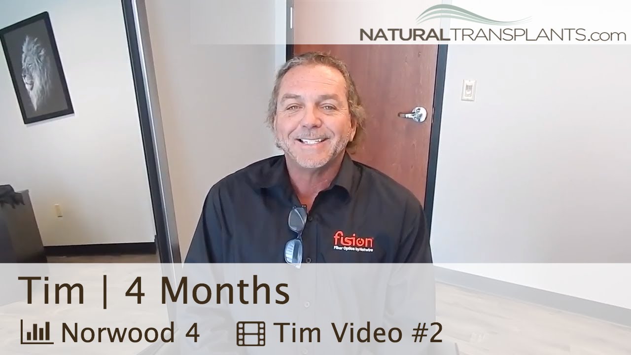 fue hair transplant month by month Transplantation of Hair | Update with Dr Harold Siegel (Tim)