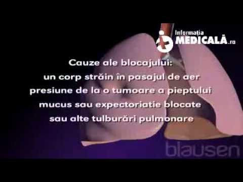 Video: Atelectazie - Descriere, Cauze, Simptome, Prognostic, Tratament