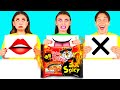 عضة لعقها أو لا شيء تحدي | مواقف مضحكة