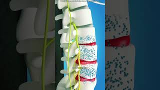 Spinal decompression therapy (3D animation)