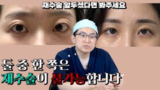 두 눈 중 하나는 재수술이 불가능합니다.(온라인 성형 상담)