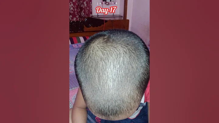 hair regrowth after shaving head|  #youtubeshorts#viralvideo#trending#shorts#hair regrowth@Rai1972