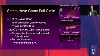Vessel Prep With Intent Atherectomy U0026 Lesion Biology  Dr Eric Dippel At Ted 2026