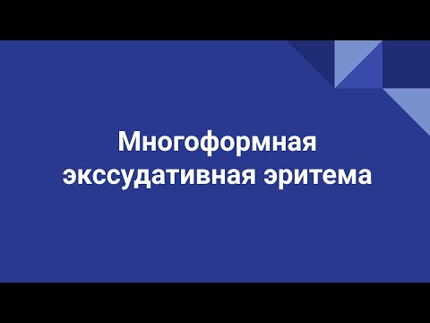 Многоформная экссудативная эритема