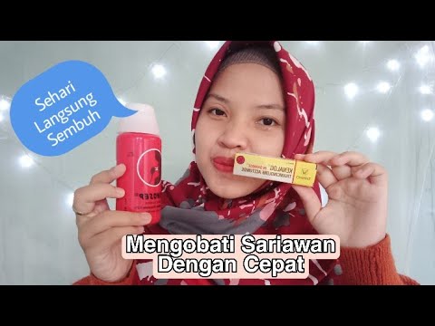 Cara Mengobati Sariawan dengan Cepat dan Tepat 