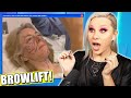 A BROWLIFT Changed Her LIFE! | Luxeria