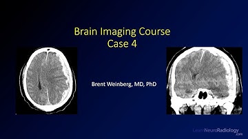 Brain imaging course – Unknown case 4