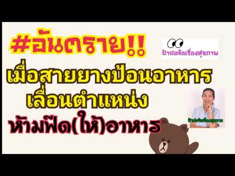 บรรยากาศดูแลผู้ป่วยที่บ้าน เมื่อสายป้อนอาหารเลื่อน-หลุด ห้าม feed เด็ดขาด หากฝืนอาจเสียชีวิตได้