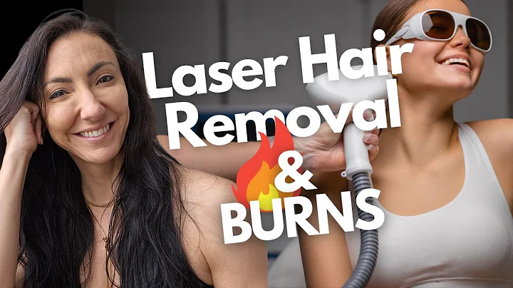 Laser Hair Removal Burns: Causes, Prevention, and Treatment Tips