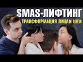 SMAS-лифтинг лица и шеи: Реальный результат спустя 2 недели и 2 месяца!