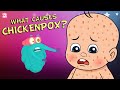 What causes chickenpox  the dr binocs show  best learnings for kids  peekaboo kidz