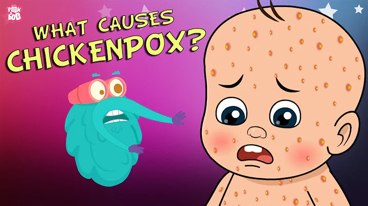 What Causes Chickenpox? | The Dr. Binocs Show | Best Learning Videos For Kids | Peekaboo Kidz - DayDayNews