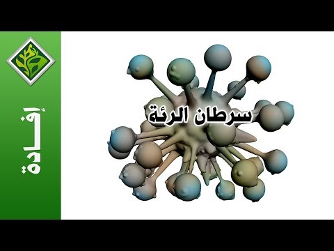 مراحل تطور مرض سرطان الرئة - مراحل تطور مرض سرطان الرئة