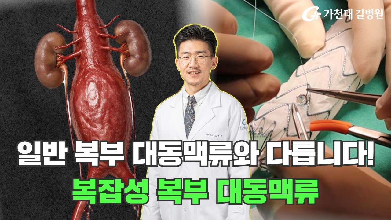 생명을 위협하는 복잡성복부 대동맥류, 어떻게 치료할까? / 혈관외과 고대식 교수