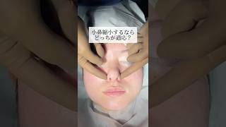 【鼻整形】小鼻縮小するならどっちが適応？#shorts