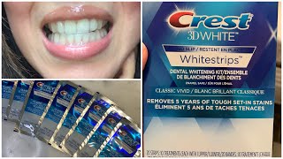 استعمال لصقات الاسنان كريست|تبييض الاسنان في البيت|crest whitening strips|blanchir les dents ?