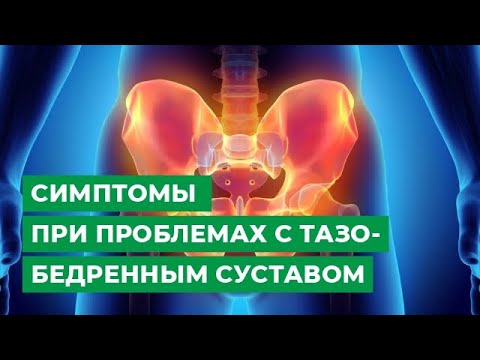 Симптомы, которые должны насторожить при проблемах с тазобедренным суставом