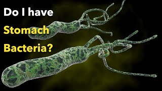 Do I need to treat the stomach bacteria Helicobacter Pylori?
