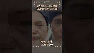 실루엣소프트 효과 높이는 조합 공개! 시술전후 #실리프팅전문 #실리프팅잘하는곳 #리프팅효과 #오브의원 #shorts