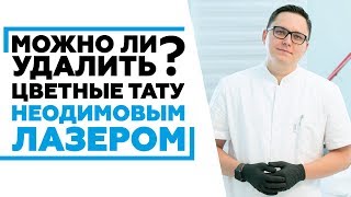 Можно ли удалить цветные тату неодимовым лазером? #лазерноеудаление #удалениетатуировок(, 2017-05-09T18:38:09.000Z)