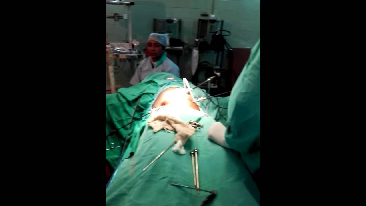 appendix operation.. YouTube