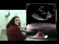 Imv imaging cardiac ultrasound 9  overview of standard rightsided views