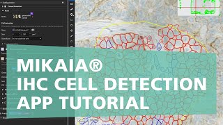 MIKAIA® - IHC Cell Detection App Tutorial