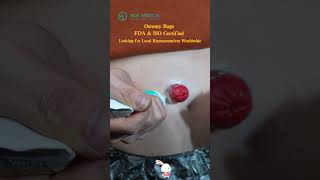 Ostomy Bags FDA & ISO Certified Looking for Local Representatives Worldwide