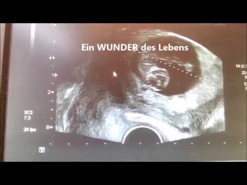 Baby Ultraschallvideo in 11. Ss-Woche